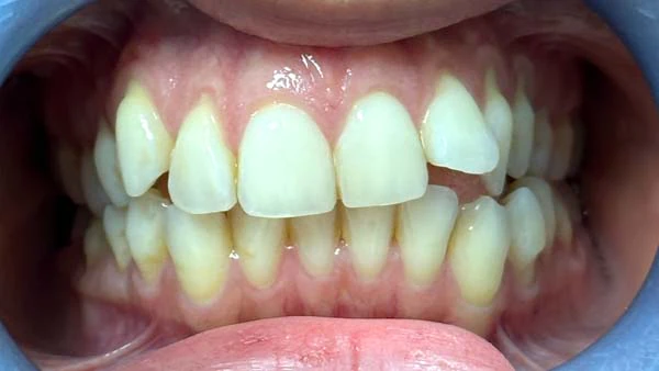 Before image