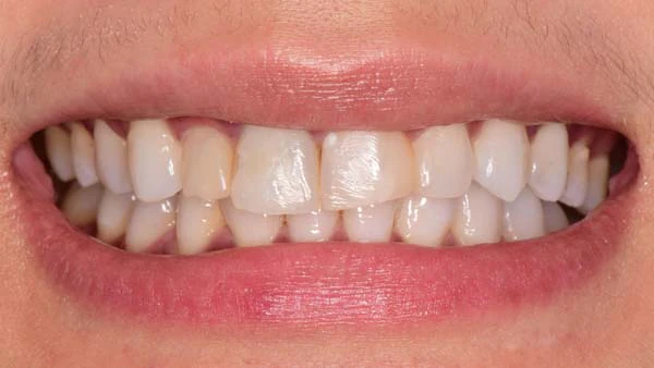 Before image