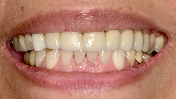 Before image