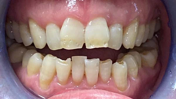 Before image