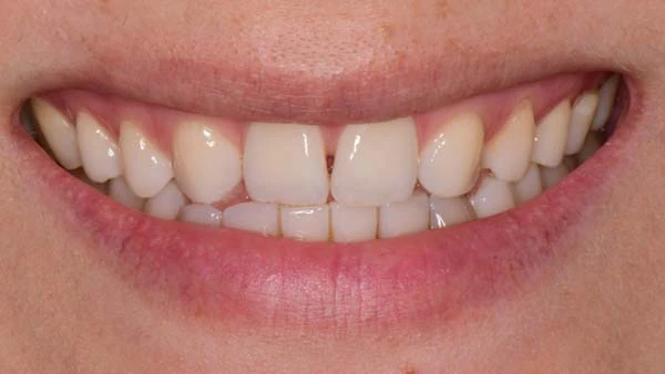 Before image