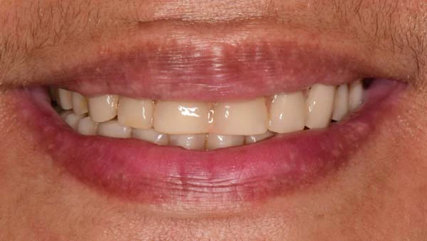 Before image