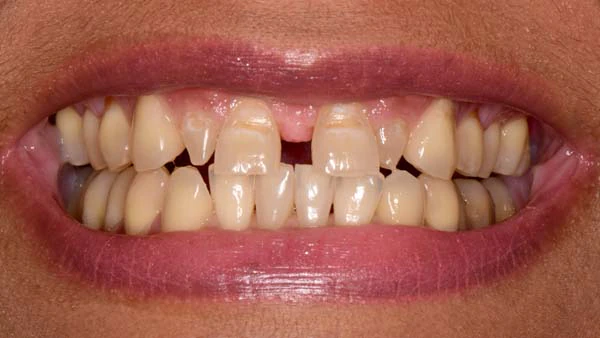 Before image